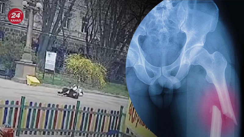 In Ternopil hat ein Junge in einem Spielzeugauto eine ältere Frau angefahren: Sie hat eine schwere Verletzung 