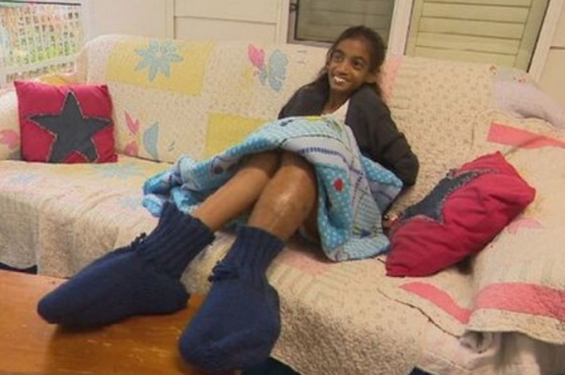 Die Beine eines 11-jährigen Mädchens sind so groß, dass sie fast amputiert wurden: Was ist das für eine Krankheit (Foto)