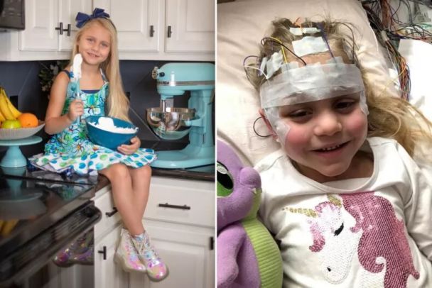 U 7 Bei dem 12-jährigen Mädchen wurde nach einem routinemäßigen Sehtest Demenz diagnostiziert.“ /></p>
<p>„Ärzte bestätigten, dass Ayla frühe Anzeichen einer Makuladegeneration im Kindesalter hatte und einen Gentest benötigte, um die Ursache zu ermitteln. Sie machten einen Abstrich bei ihr.“ Mund und vereinbarte einen Folgetermin für uns im August, als die Ergebnisse eintrafen“, erinnert sich die Mutter.</p>
<p>„Am 12. August wurde mir mitgeteilt, dass das genetische Panel von Isla die Diagnose „Neuronale Ceroid-Lipofuszinose“ positiv befunden hat. Nach weiteren Erklärungen erfuhren wir, dass diese Krankheit allgemein als Juvenile Batten-Krankheit bekannt ist, eine sehr seltene, äußerst seltene Krankheit. A verheerende, tödliche Krankheit ohne Heilung.“< /p> </p>
<p>Der Frau wurde auch gesagt, dass Ayla sehr bald ihr Augenlicht vollständig verlieren würde, dass sie im Kindesalter an Demenz und Epilepsie erkranken würde, dass ihre geistigen Fähigkeiten nachlassen würden und dass sich auch ihre körperlichen Fähigkeiten verschlechtern würden. Die Lebenserwartung eines erkrankten Kindes betrug Ende Teenager, Anfang 20.</p>
<p>Innerhalb von drei Jahren nach der Diagnose hatte Ayla bereits etwa 90 % ihres Sehvermögens verloren. Ihre Eltern sagten jedoch, sie passe sich gut an den Verlust an und lerne unter anderem, Blindenschrift zu lesen.</p>
<p><img decoding=