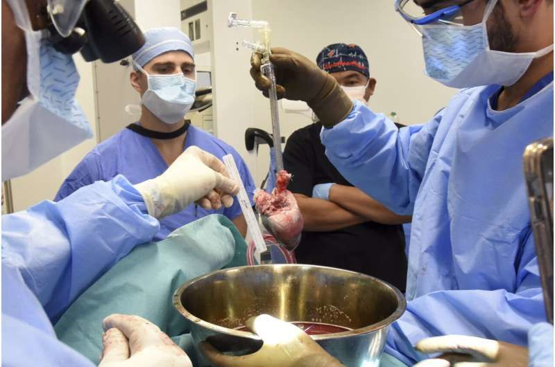 Der zweite Mann in der Geschichte, der empfangen hat ein transplantiertes Schweineherz, starb 6 Wochen nach der Operation (Foto)“ /></p>
<p>Das Faucette gegebene Herz wurde modifiziert, um bestimmte Schweinegene zu entfernen und auch menschliche Gene hinzuzufügen, um eine Abstoßung zu verhindern.</p>
<p> < p >Letztes Jahr wurde UMCC fertiggestellt<strong>die weltweit erste Schweineherztransplantation</strong> an den 57-jährigen David Bennett Sr., der zwei Monate lang mit dem Organ lebte, bevor er sich mit dem Schweinevirus infizierte.</p>
<p>„Wie beim ersten Patienten, David Bennett Sr., beabsichtigen wir, eine umfassende Analyse durchzuführen, um Faktoren zu identifizieren, die bei zukünftigen Transplantationen verhindert werden können; dies wird es uns ermöglichen, weiter voranzukommen und unsere Kollegen in diesem Fachgebiet weiterzubilden.“ „, fügte er hinzu. Chirurg Muhammad Mohiuddin. „Wir können Faucette und seiner Familie nicht genug dafür danken, dass sie es uns ermöglicht haben, weiterhin bedeutende Fortschritte bei der Verwirklichung von Xenotransplantaten zu machen.“</p>
<p><img decoding=