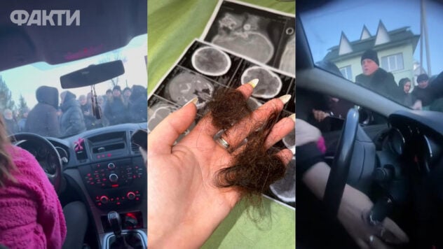 Sie dachten, dass die TCC zu ihnen käme: In Kosmach, Region Iwano-Frankiwsk, schlug eine Menschenmenge ein Kind und zwei Frauen zusammen Sie dachten, dass die TCC zu ihnen käme: in Kosmach, Region Iwano-Frankiwsk, a Menschenmenge schlug ein Kind und zwei Frauen“ /></p>
<p>Im Dorf Kosmatsch in der Region Iwano-Frankiwsk schlugen Anwohner zwei Frauen und die sechsjährige Tochter einer von ihnen. Die Menge blockierte die Straße und stoppte Autos. Die Leute wollten sicherstellen, dass es keine Personen gab, die mit Vertretern des Territorial Acquisition Center (TCC) in Verbindung standen.</p>
<h2>Was geschah</h2>
<p>Eine der Frauen, die das Auto fuhr, <strong >Ivanna Vanjurak </strong>wurde der Zusammenarbeit mit TCC verdächtigt. Die Menge schlug auf die Frau und ihre sechsjährige Tochter ein. Es gelang ihr, wegzulaufen, weil die Aufmerksamkeit der Leute auf ein anderes Fahrzeug gelenkt wurde.</p>
<p><strong>Warum schlug die Menge Frauen mit einem Kind in der Region Kosmatsch</strong>Iwano-Frankiwsk zusammen und wie reagierte die Polizei? — ICTV-Fakten gelernt.</p>
<p>Jetzt </p>
<h2> ansehenAngriff in Kosmach</h2>
<p>Ivanna Vandzhurak lebt im Nachbardorf Brustury, das 7,5 km von Kosmach entfernt liegt. Am Nachmittag des 6. Februar fuhr Ivanna nach Kosmach, um ein Paket entgegenzunehmen.</p>
<p>Zuerst hielten unbekannte Frauen sie auf der Straße an und begannen, Ivanna in obszöner Sprache zu fragen, wer sie sei und warum sie gekommen sei den ersten Platz. Die Frau antwortet, dass sie nach Nova Poshta unterwegs ist.</p>
<p>Als Reaktion auf Ivanna rief jemand aus der Menge, dass sie angeblich filme. Sie zeigte die Galerie auf ihrem Handy und wurde daraufhin freigelassen. Doch auf dem Heimweg wurde Ivannas Straße erneut blockiert.</p>
<blockquote>
<p>— Es waren viele wütende Menschen auf der Straße. Sie kamen mit Drohungen auf mich zu und begannen zu schreien: „Wo gehst du hin, du?“ mit TCC. Ich sage: Ich habe gerade mit dir gesprochen. Ich— Einheimische aus einem Nachbardorf. Und jemand rief: „Du — Schütze des Militärregistrierungs- und Einberufungsamtes. Sie haben dem Kind auch keine Beachtung geschenkt, — Ivanna hat geteilt.</p>
</blockquote>
<p>Sie teilte mit, dass sich in der Menge bis zu 70 Menschen befanden, darunter Frauen und Männer unterschiedlichen Alters. Sie zogen Ivanna an den Haaren aus dem Fenster und fingen an, sie auf das Auto zu schlagen und zu schlagen. Ivanna schrie, dass ein Kind im Auto sei, aber diese Leute kümmerten sich nicht darum und zogen die Frau weiter heraus.</p>
<p>Später rief jemand aus der Menge, dass es das falsche Auto sei, und sie rannten davon zu einem anderen. Ivanna startete das Auto, fuhr davon und rief an einem sichereren Ort Ärzte und Polizei. Sie erzählte, dass ihre Tochter ein blutiges Gesicht und eine gebrochene Nase hatte.</p>
<blockquote>
<p>— Die Tochter weinte viel. Mein Kopf tat auch sehr weh, ich habe nichts verstanden. Dann traf die Polizei in der Menge ein. Die Leute fingen an, sie anzuschreien und drohten, das Auto anzuzünden: — sie bemerkte es.</p>
</blockquote>
<p><iframe Loading=